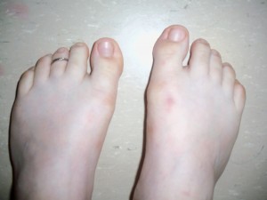 My feet looking very, very alternative